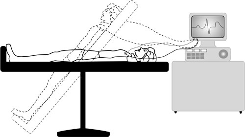 Tilt table heart test